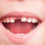 RFK Jr’s plan to ban fluoride supplements will “hurt rural America,” dentists say