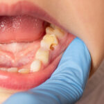 RFK Jr.’s fluoride ban would ruin 25 million kids’ teeth, cost $9.8 billion